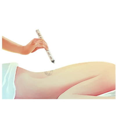 Duração de vida útil Máquina de moxibustição sem fumaça para terapia de medicina tradicional chinesa